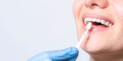 Great Expectations: Mitigating Challenges in Cosmetic Dentistry